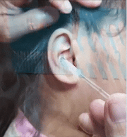 Nettoyeur d'oreilles KHAELLIA